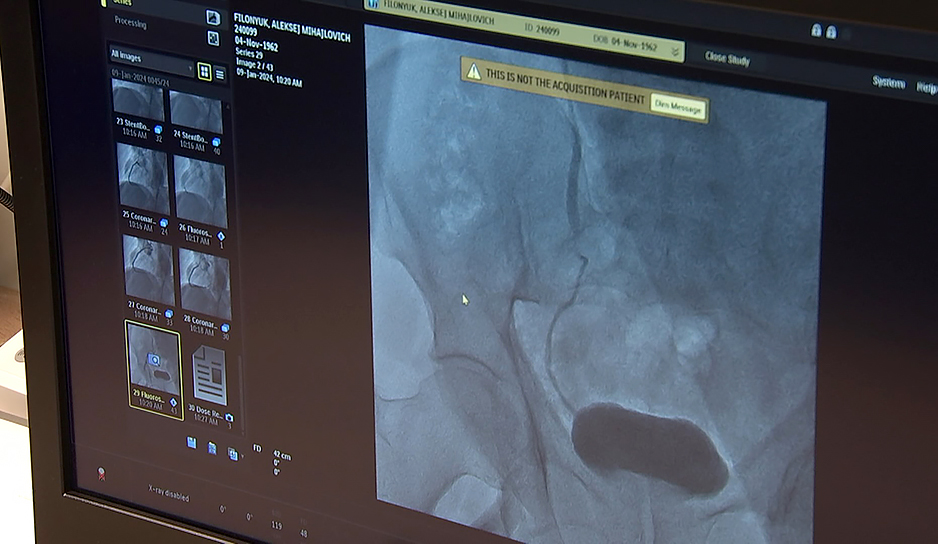 Уникальную операцию по протезированию аортального клапана впервые выполнили в Гродненском кардиоцентре