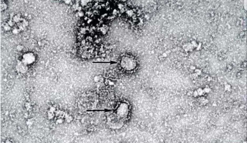 Снимок нового коронавируса