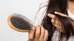 Выпадение волос связано с гормональным сбоем в организме, так ли это - отвечает специалист