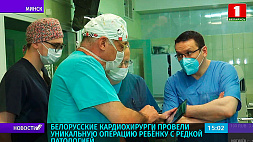 Белорусские кардиохирурги провели уникальную операцию ребенку с редкой патологией 